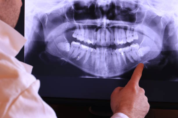 Best Weekend Emergency Dentist in Flowery Branch, GA