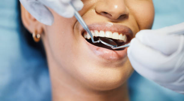 Best Emergency Treatment for Dental Infections or Abscesses in Flowery Branch, GA