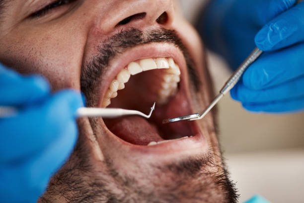 Best Emergency Dental Care for Broken or Chipped Teeth in Flowery Branch, GA